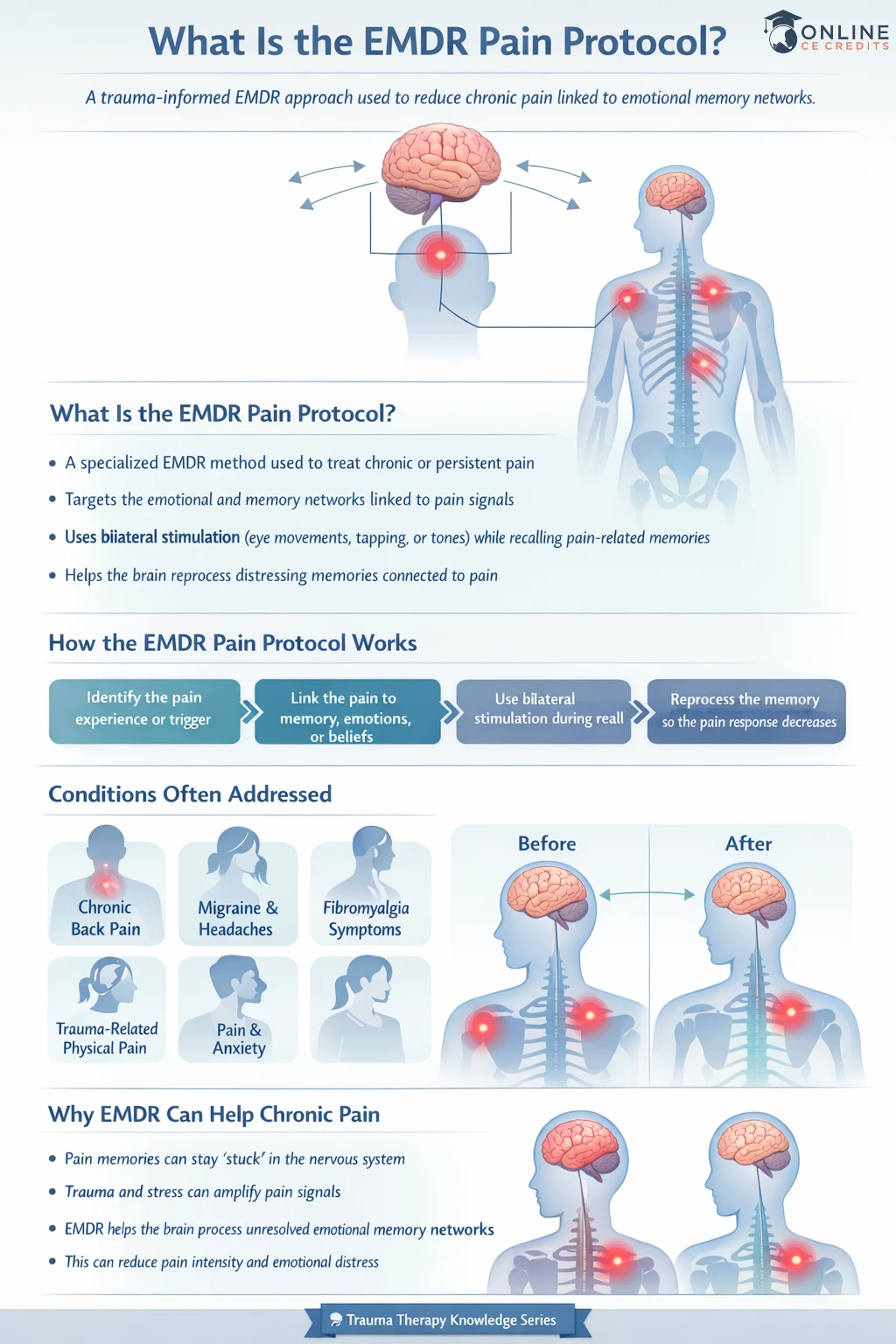 What is EMDR pain protocol infographic